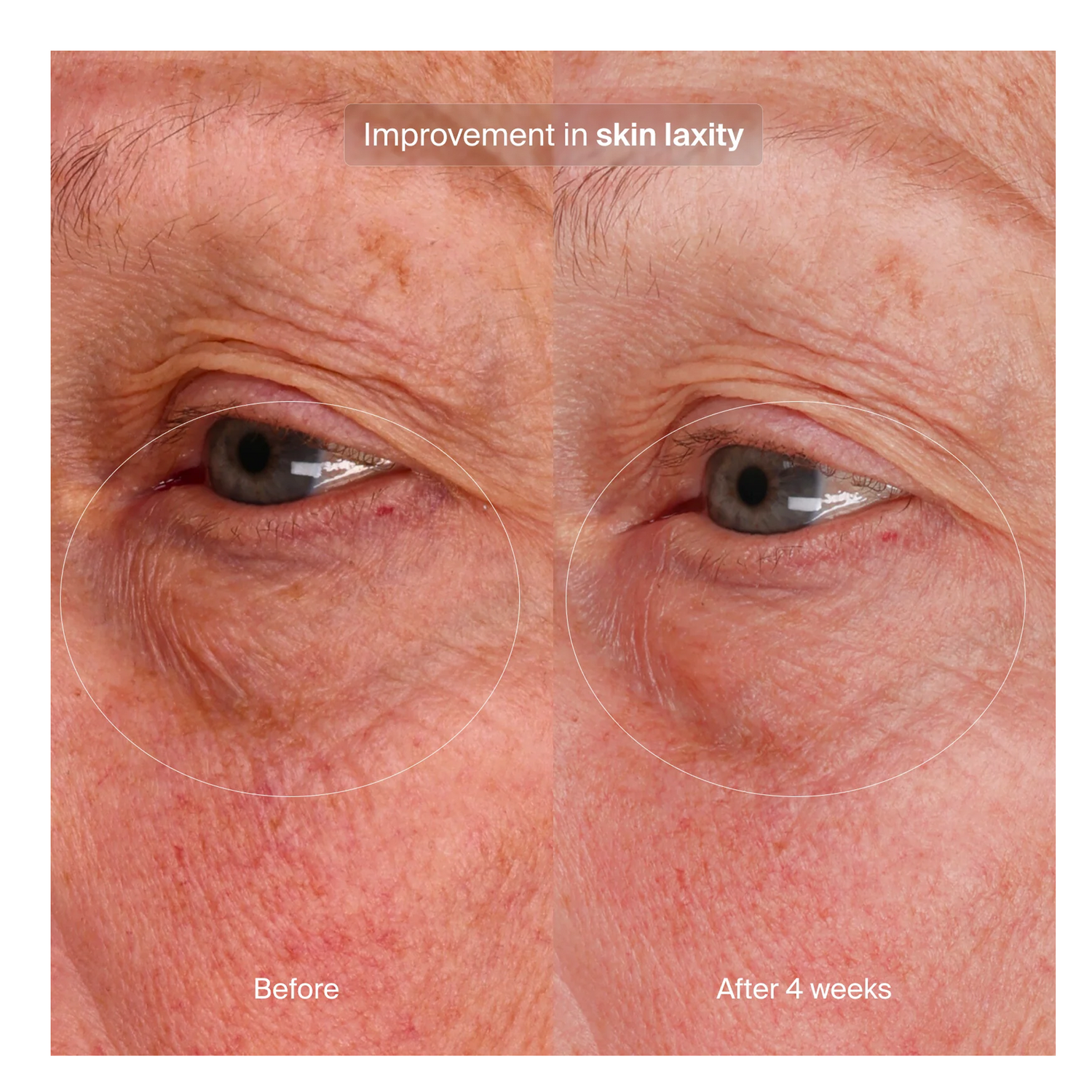 Pavise Bioadaptive Stress Repair