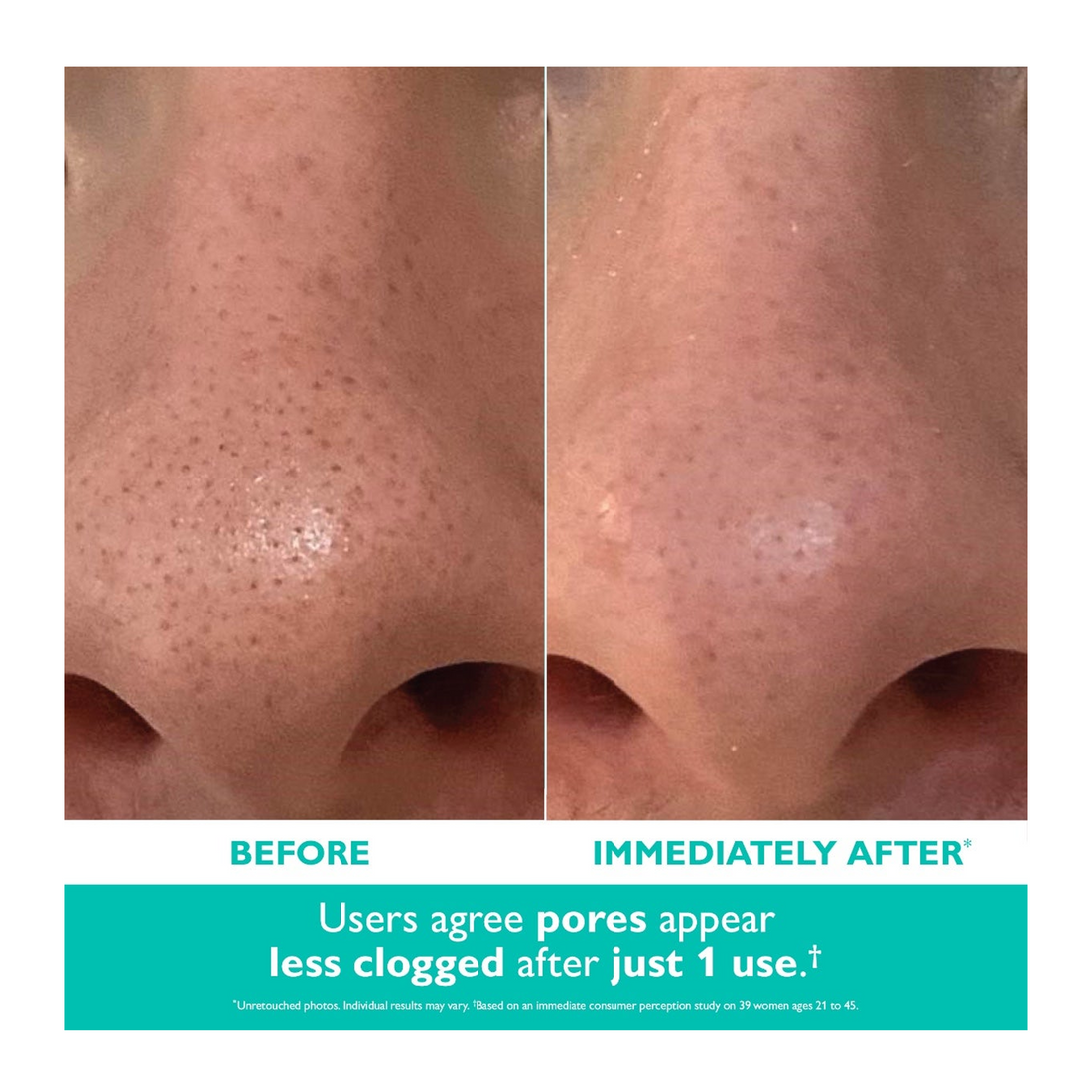 Peter Thomas Roth Even Smoother Microdermabrasion Exfoliating Pore Purifier