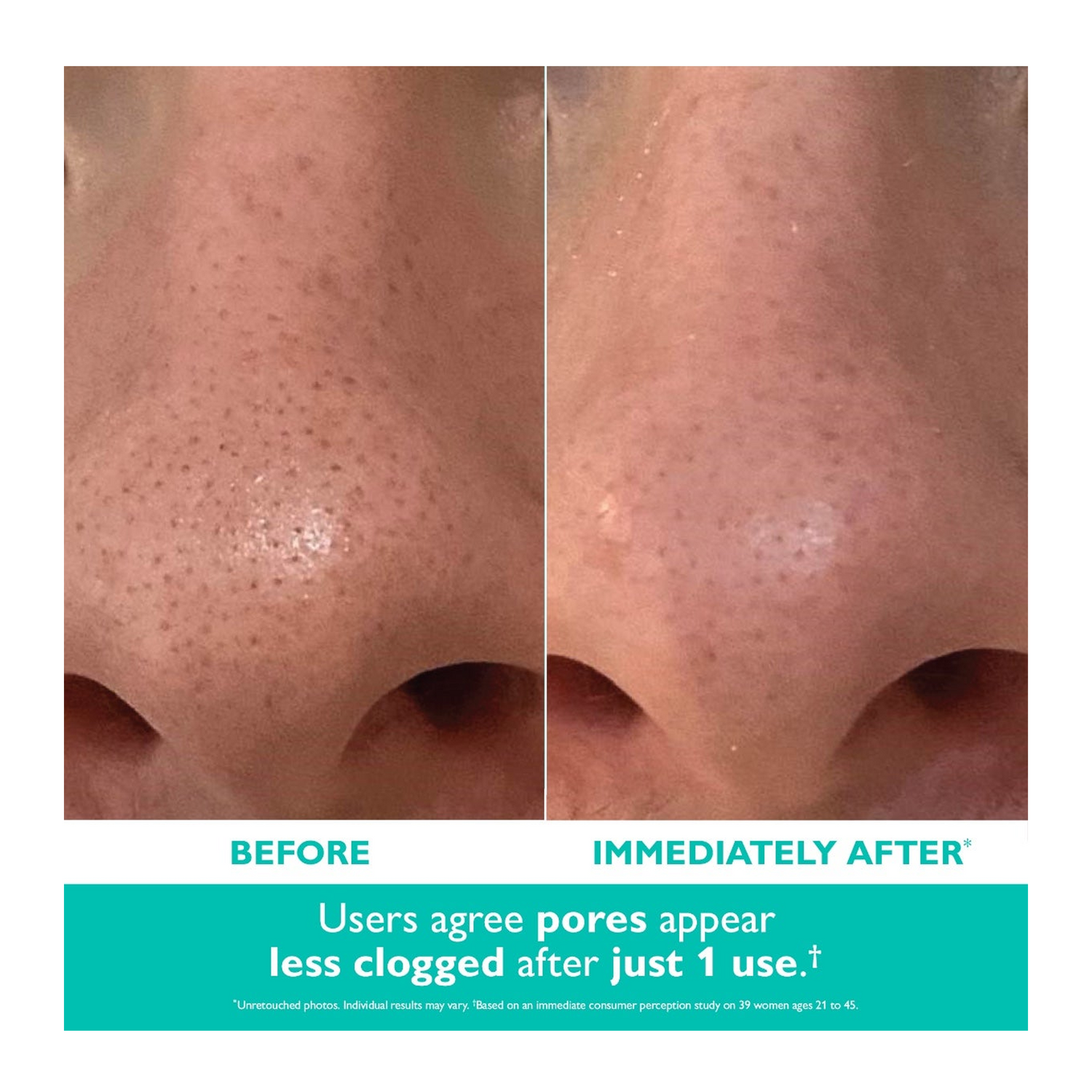 Peter Thomas Roth Even Smoother Microdermabrasion Exfoliating Pore Purifier