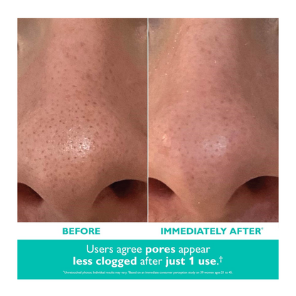 Peter Thomas Roth Even Smoother Microdermabrasion Exfoliating Pore Purifier
