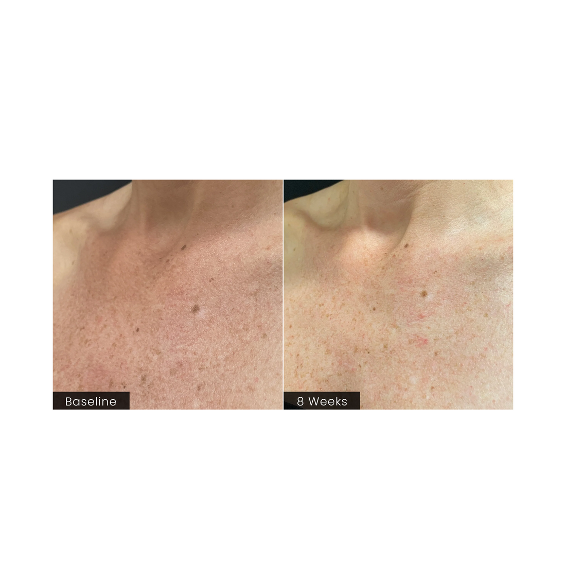 Plated BODY Serum