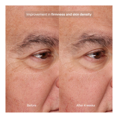 Pavise Precision Eye Lift