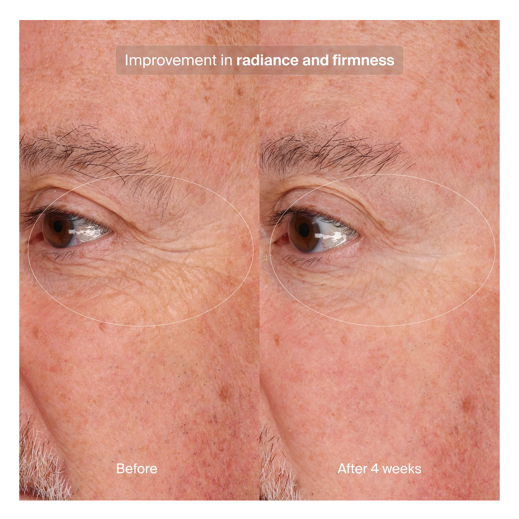 Pavise Precision Eye Lift