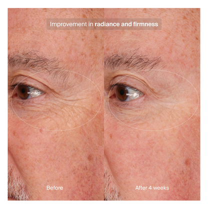 Pavise Precision Eye Lift