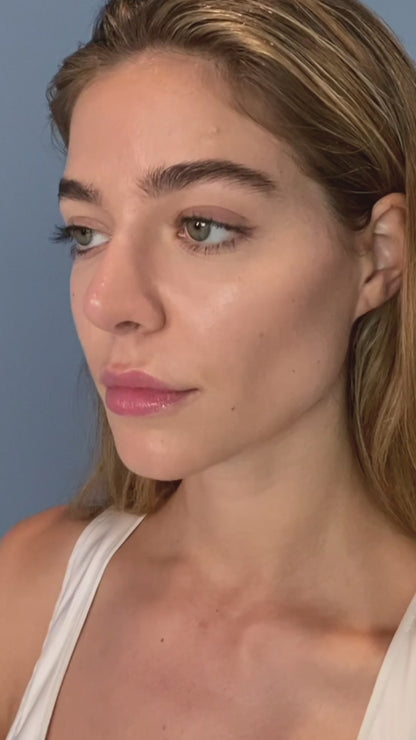 iS Clinical Active Peel Treatment System (30 Day Supply)