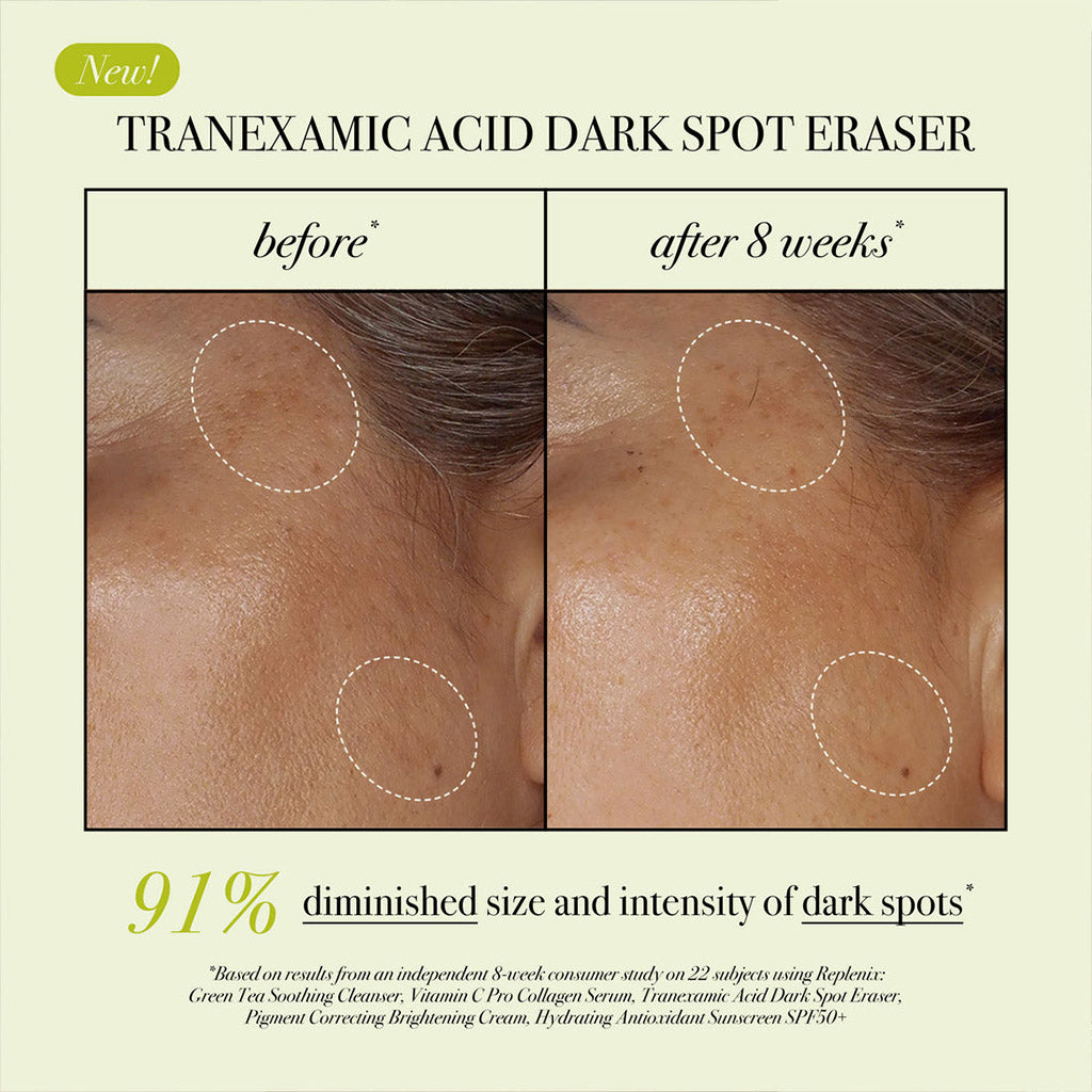 Replenix Tranexamic Acid Dark Spot Corrector