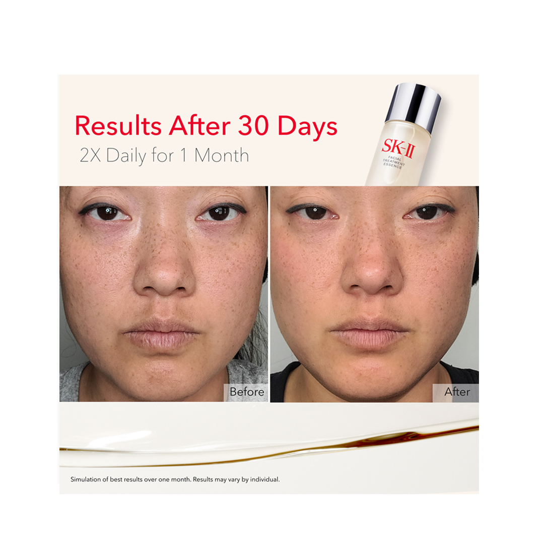 SK-II Facial Treatment Essence (XL 11.2 oz)