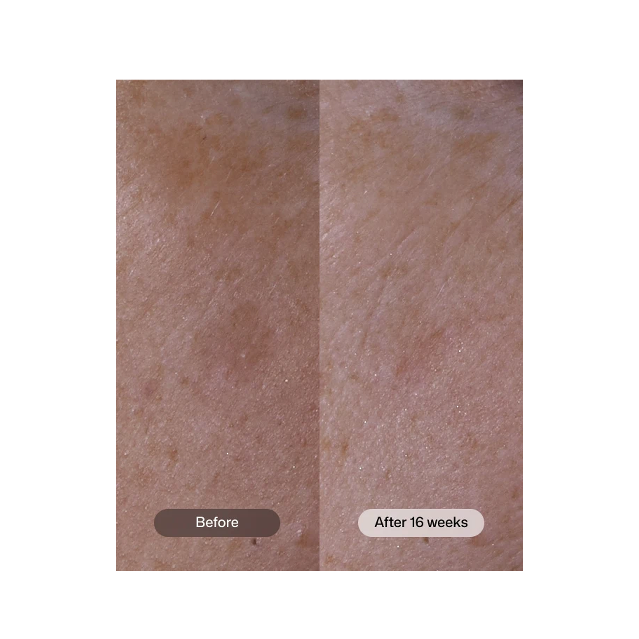 Revision Skincare Advanced Pigment Corrector+
