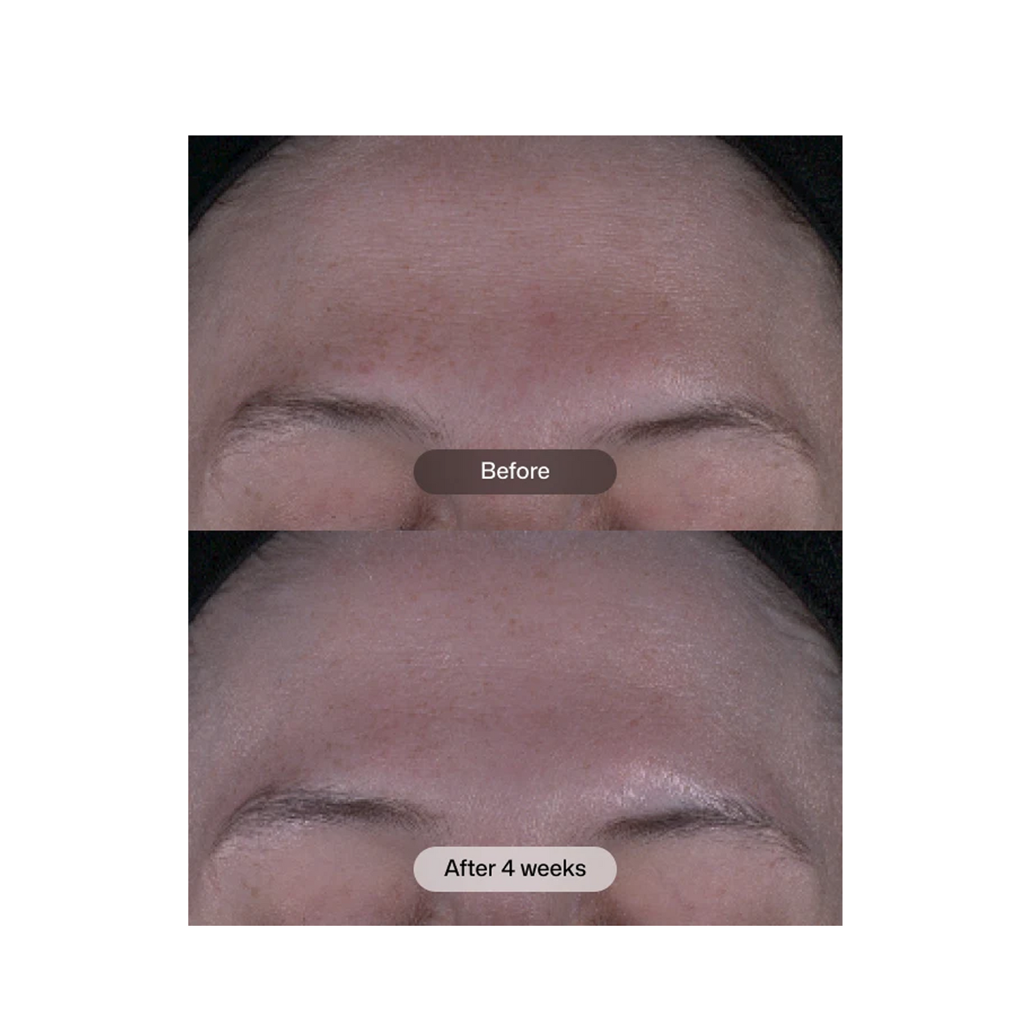 Revision Skincare Tone+ Correcting Pads™ 30 Pads