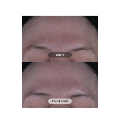 Revision Skincare Tone+ Correcting Pads™ 30 Pads
