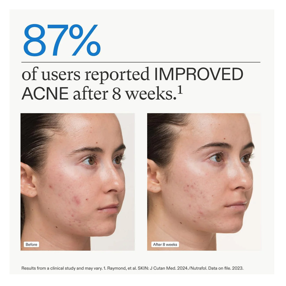 Nutrafol Women Clear Skin