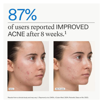 Nutrafol Women Clear Skin