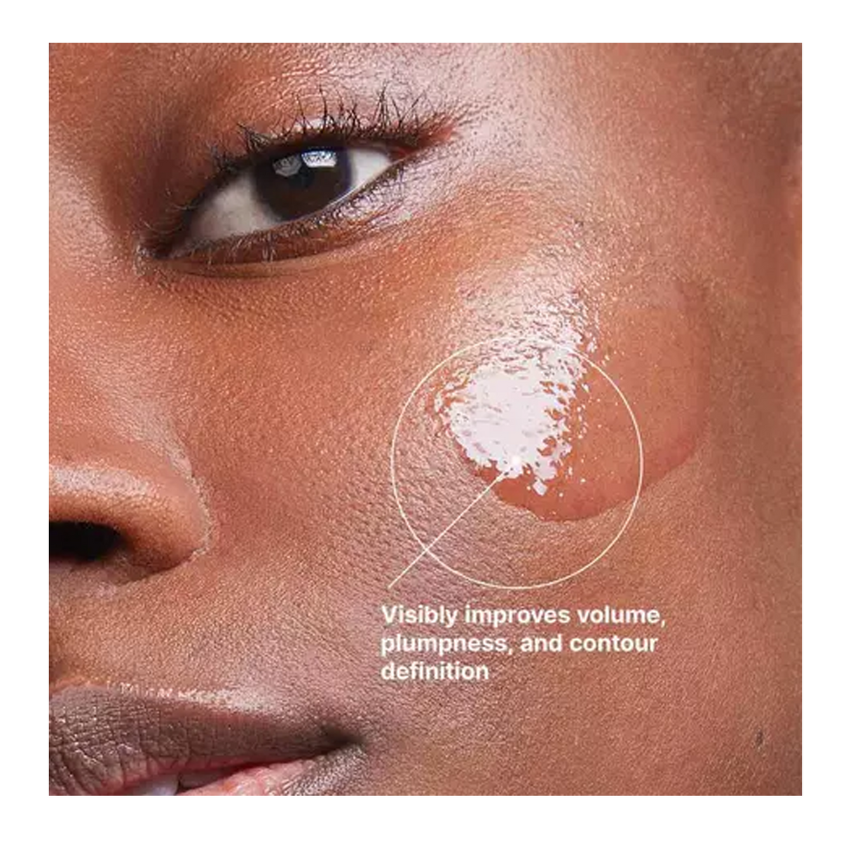 SkinCeuticals Injectables Power Pair