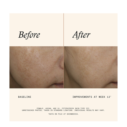 SkinMedica Even &amp; Correct Advanced Brightening Treatment