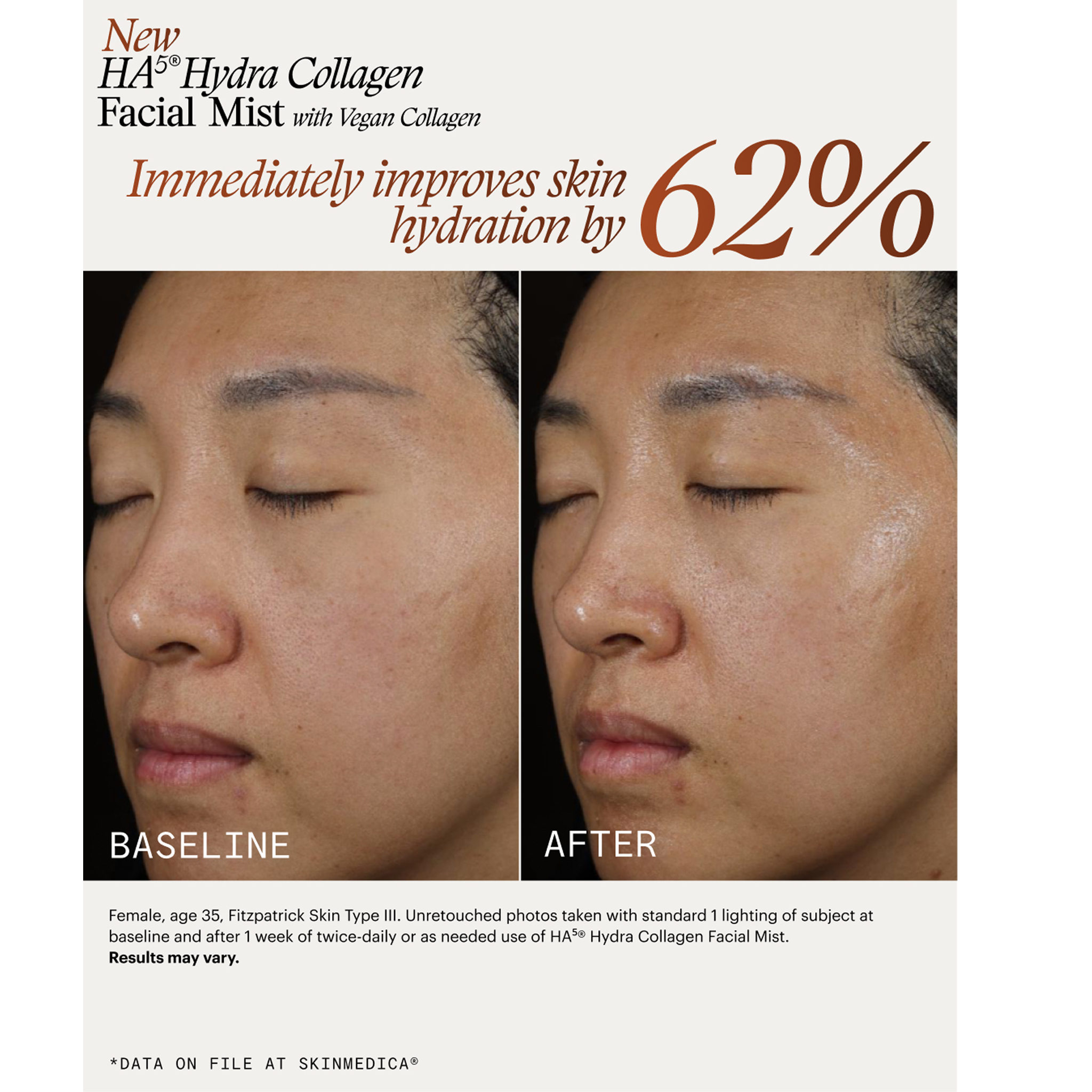 Skinmedica HA5 Hydra Collagen Facial Mist