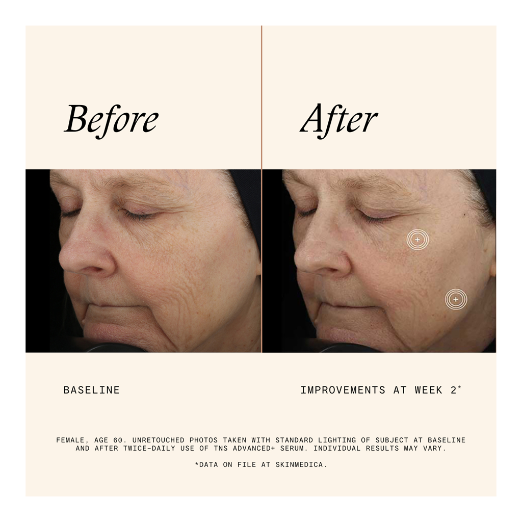 SkinMedica TNS Advanced+ Serum