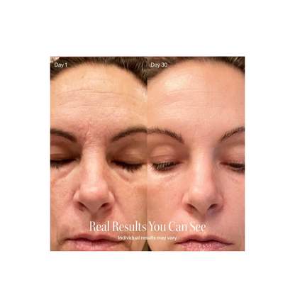 Solawave 4-in-1 Radiant Renewal Skincare Wand
