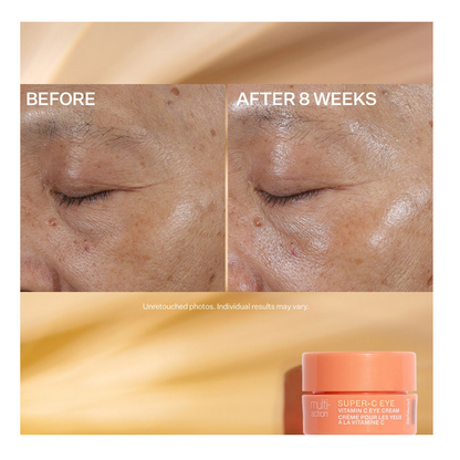 StriVectin Multi-Action Super-C Brighten &amp; Correct Trio Kit