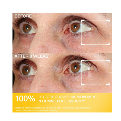 StriVectin Contour Restore Firming Moisture Balm for Eyes