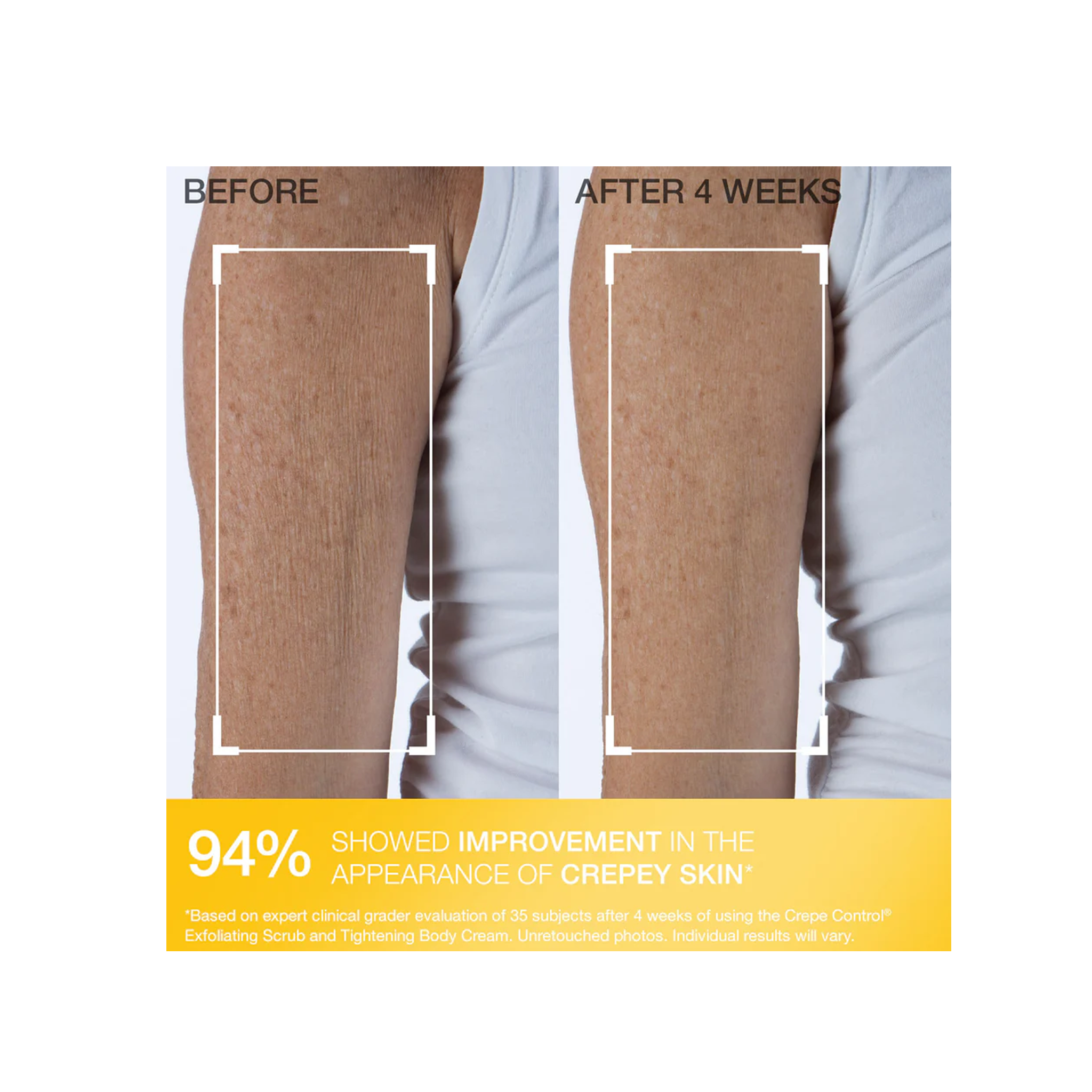 StriVectin Crepe Control Tightening Body Cream