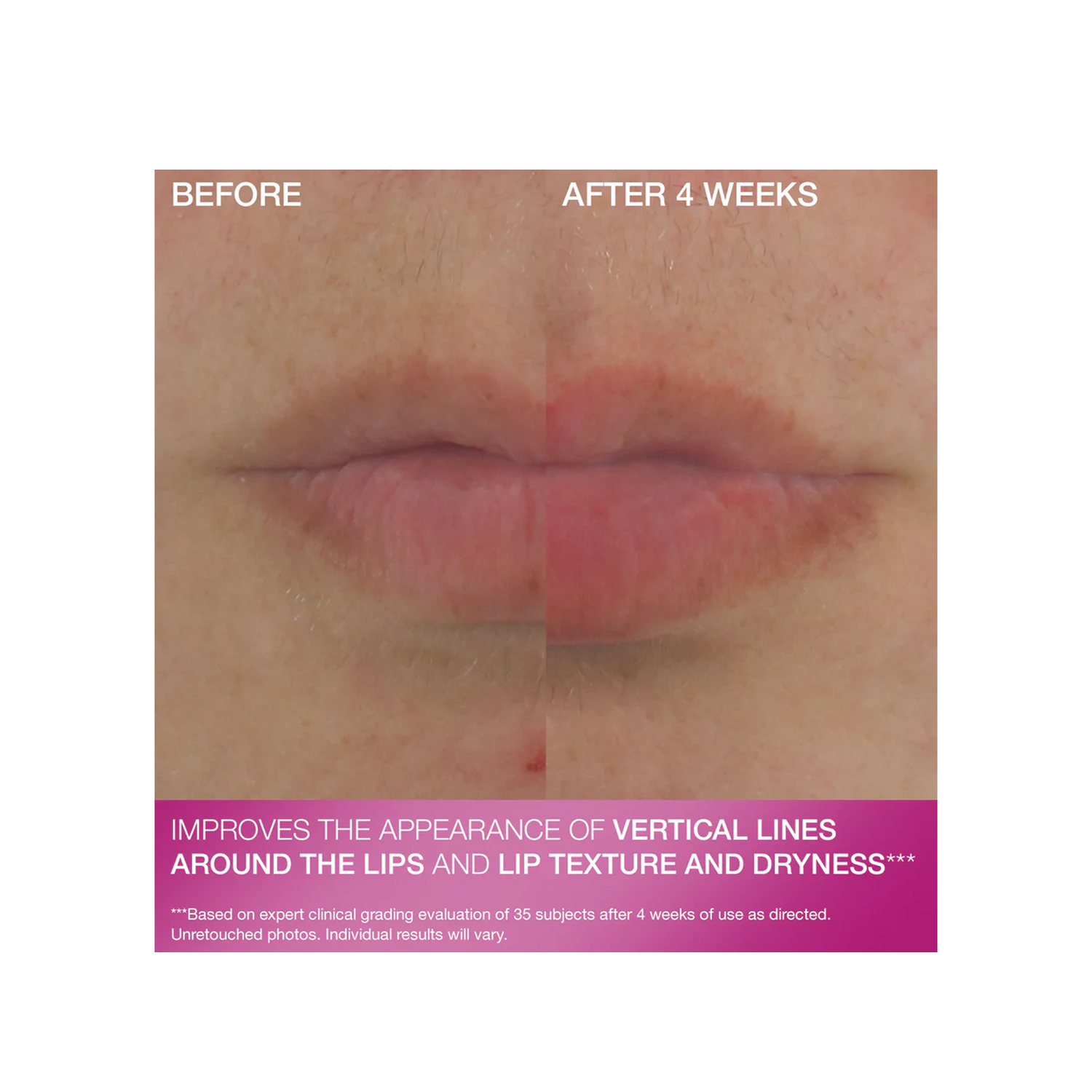 StriVectin Double Fix For Lips