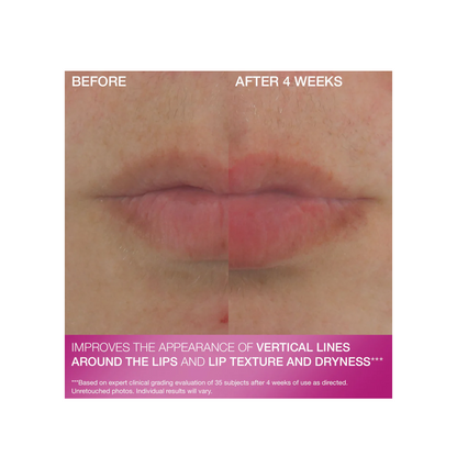StriVectin Double Fix For Lips