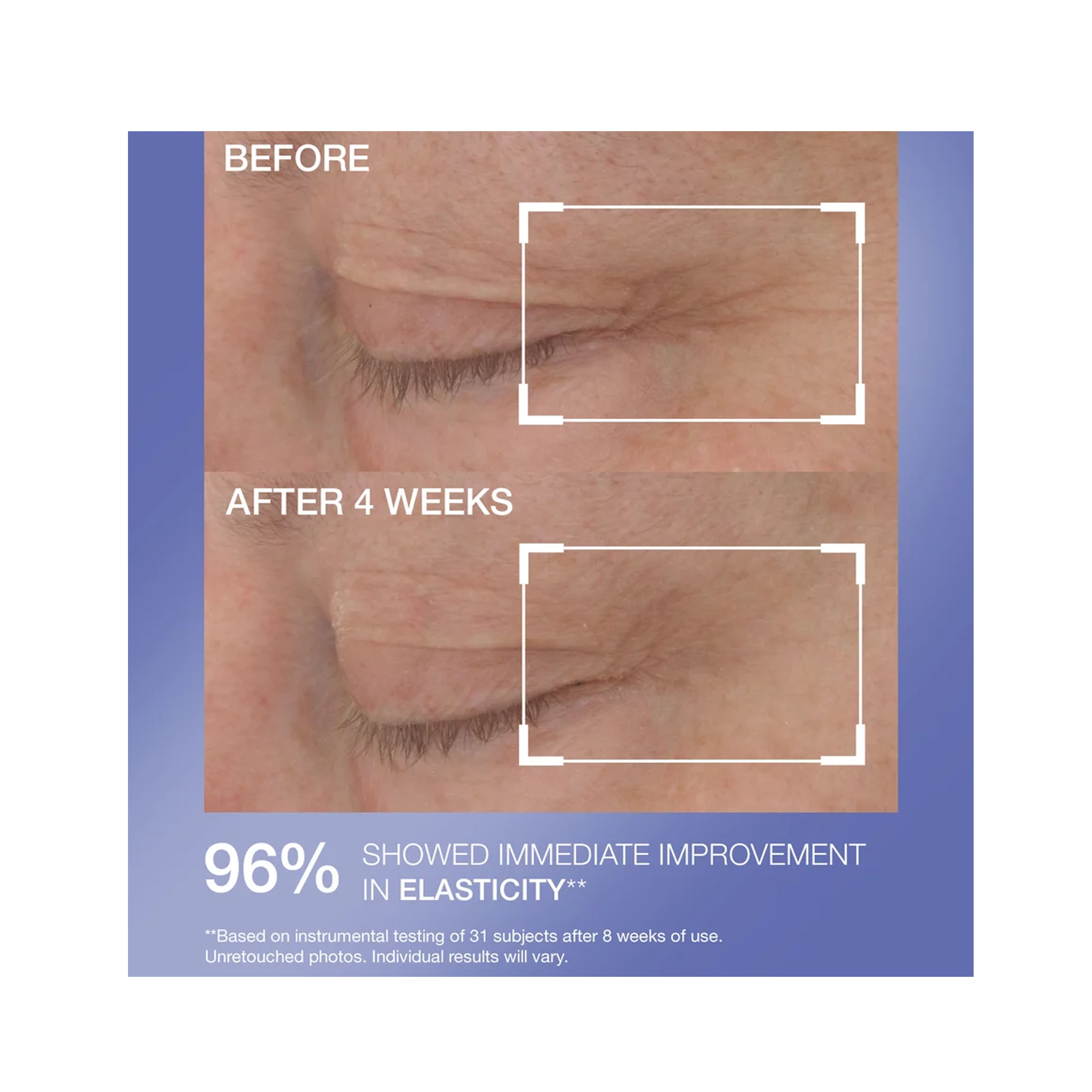 StriVectin Hyaluronic Tripeptide Gel-Cream For Eyes