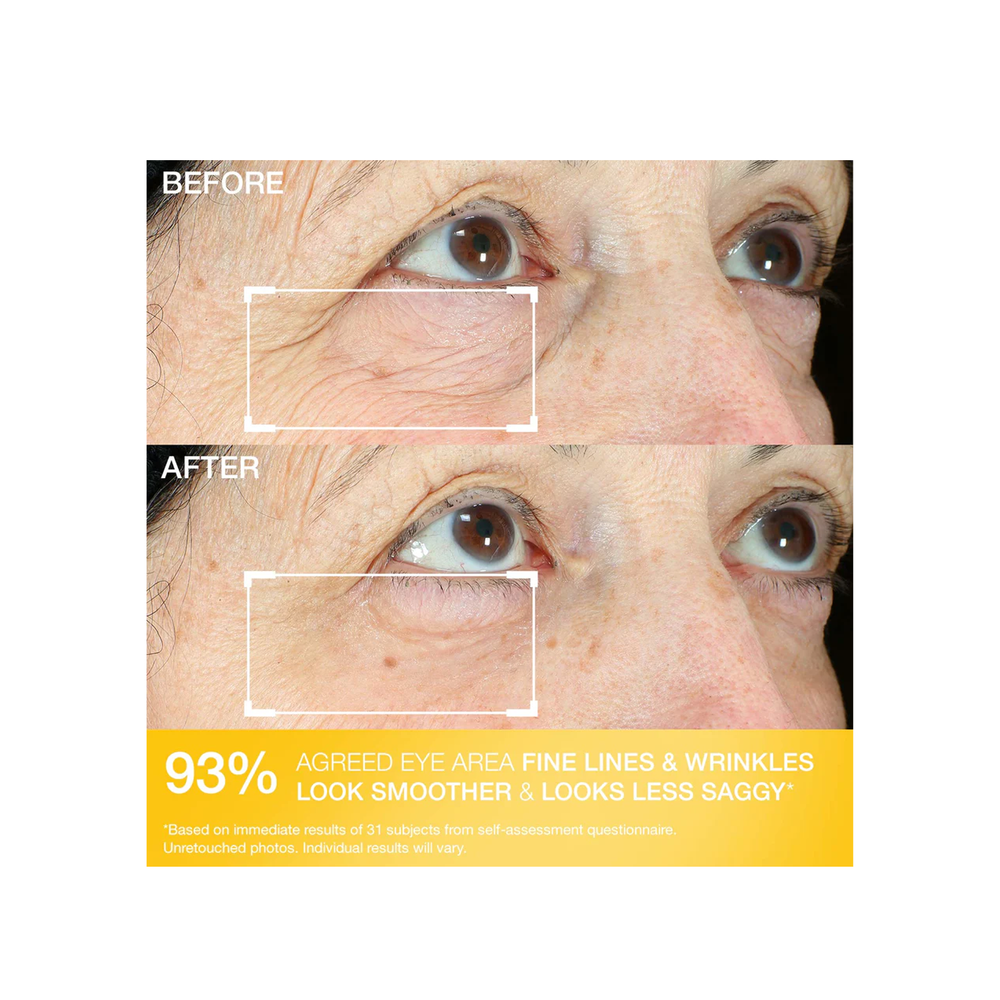 StriVectin Hyperlift Eye Instant Fix