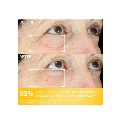 StriVectin Hyperlift Eye Instant Fix