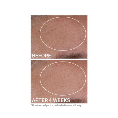 StriVectin Multi-Action Hydration Multiplier Hyaluronic Acid Serum