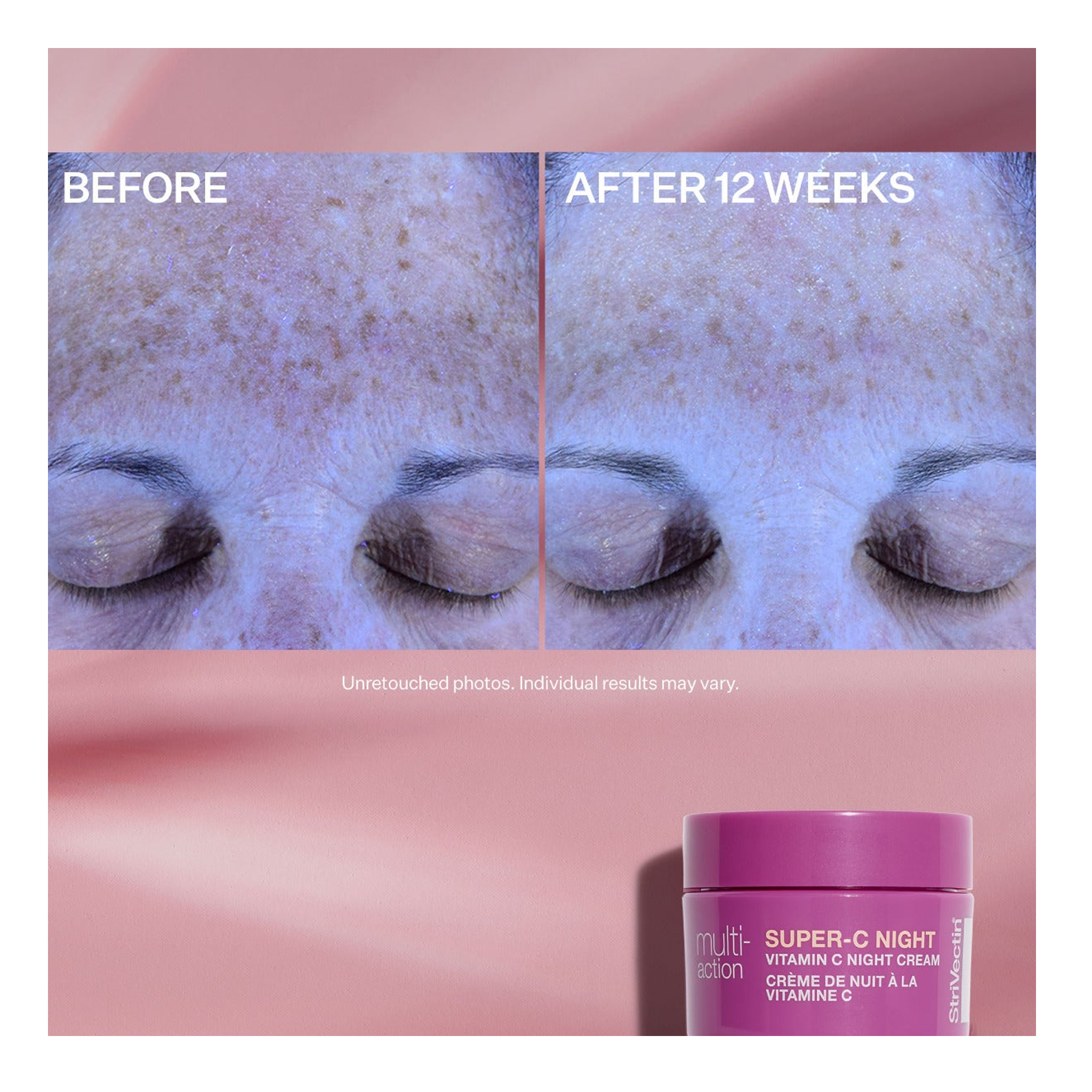 StriVectin Multi-Action Super-C Brighten &amp; Correct Trio Kit