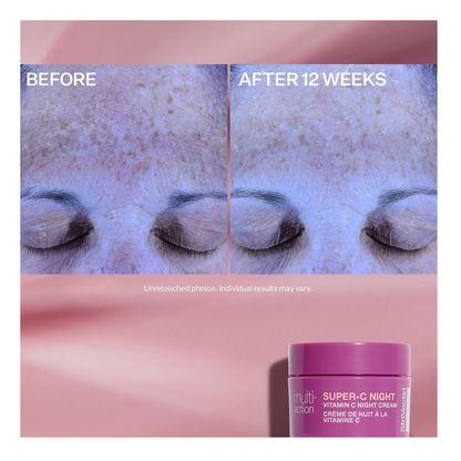 StriVectin Multi-Action Super-C Brighten &amp; Correct Trio Kit