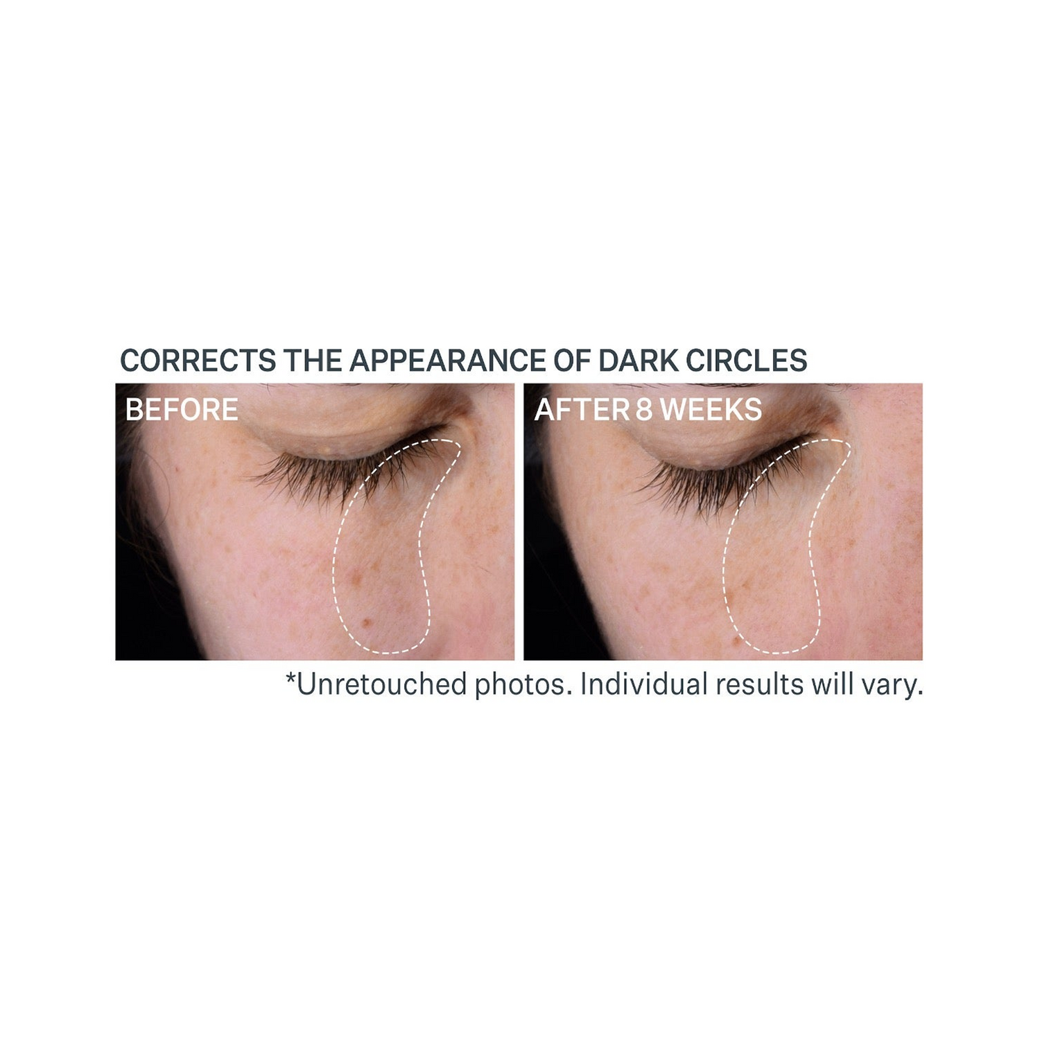 StriVectin Multi-Action Super-C Dark Circle Brightening Eye Serum