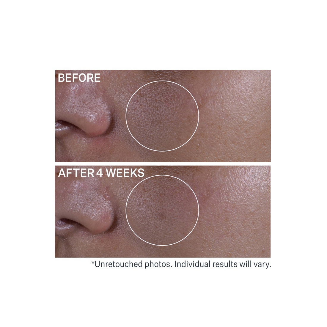 StriVectin Multi-Action Super Shrink Pore Minimizing Serum