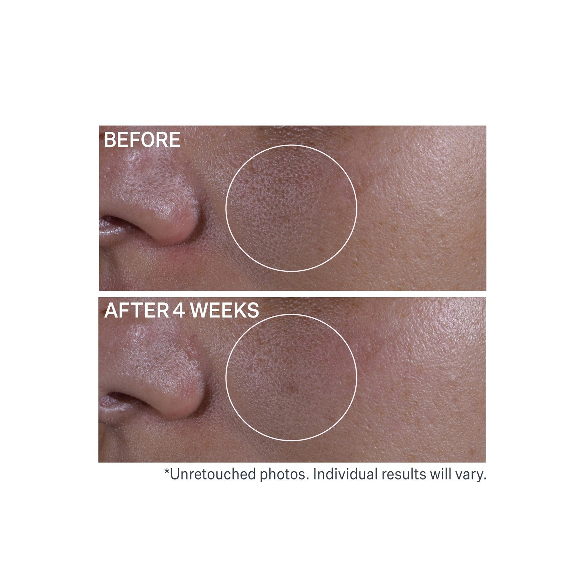 StriVectin Multi-Action Super Shrink Pore Minimizing Serum