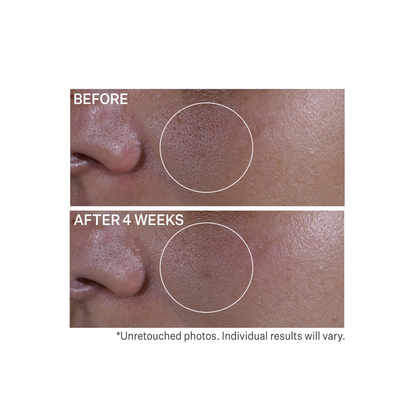 StriVectin Multi-Action Super Shrink Pore Minimizing Serum