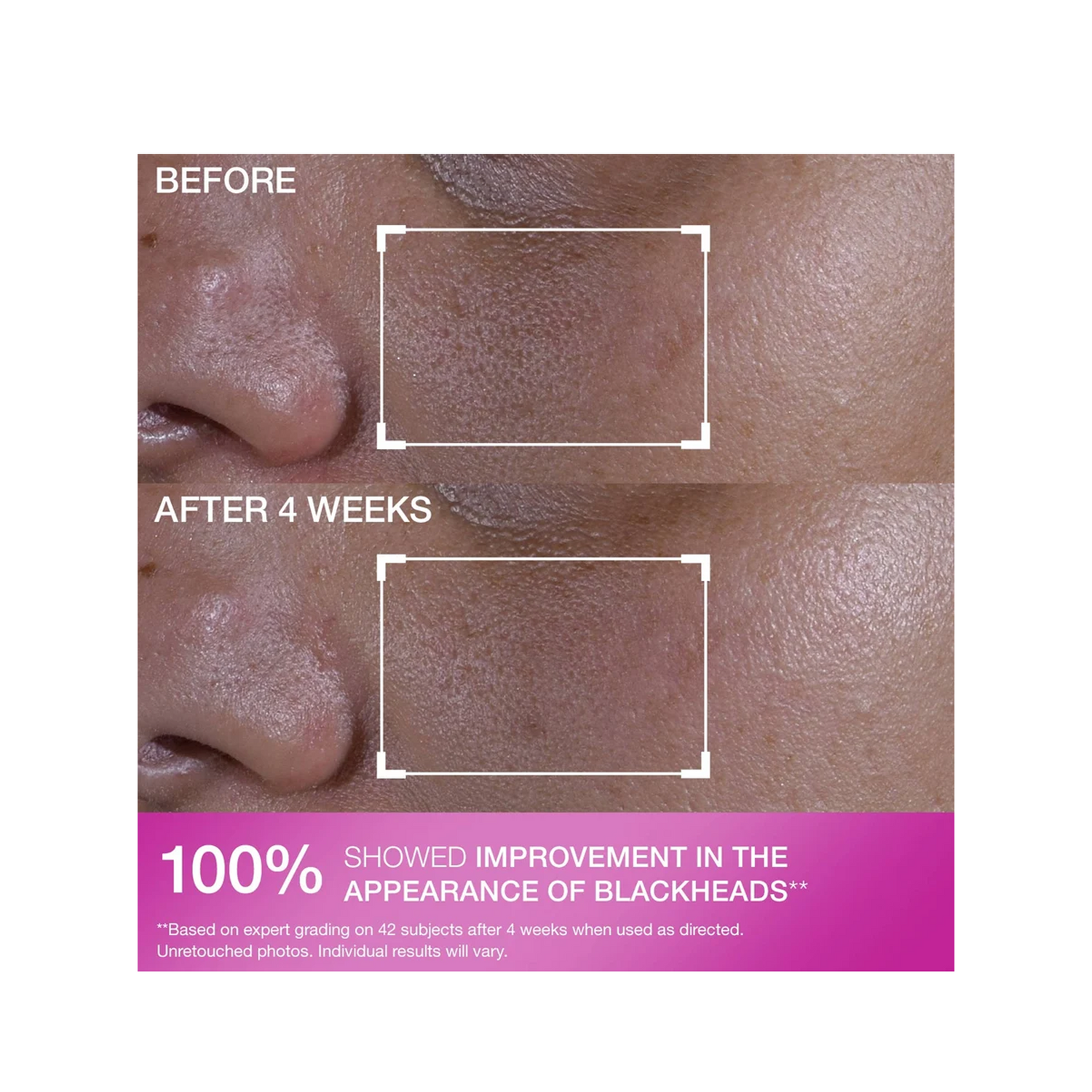 StriVectin Multi-Action Super Shrink Pore Minimizing Serum