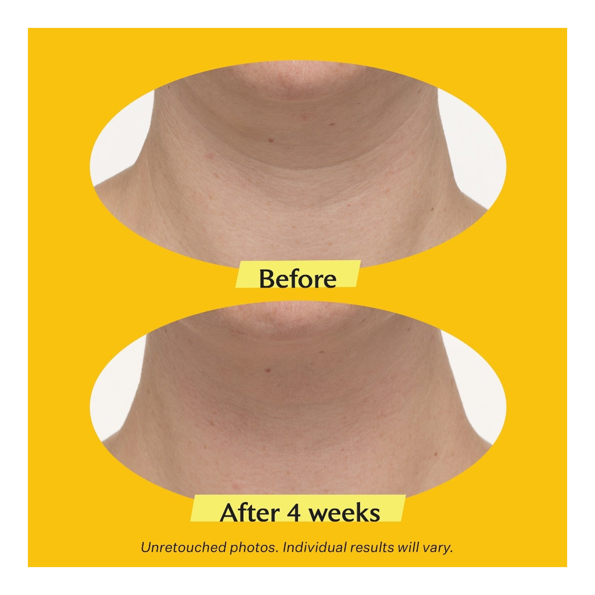 StriVectin Tightening Neck Cream PLUS With Alpha-3 Peptide 50ml