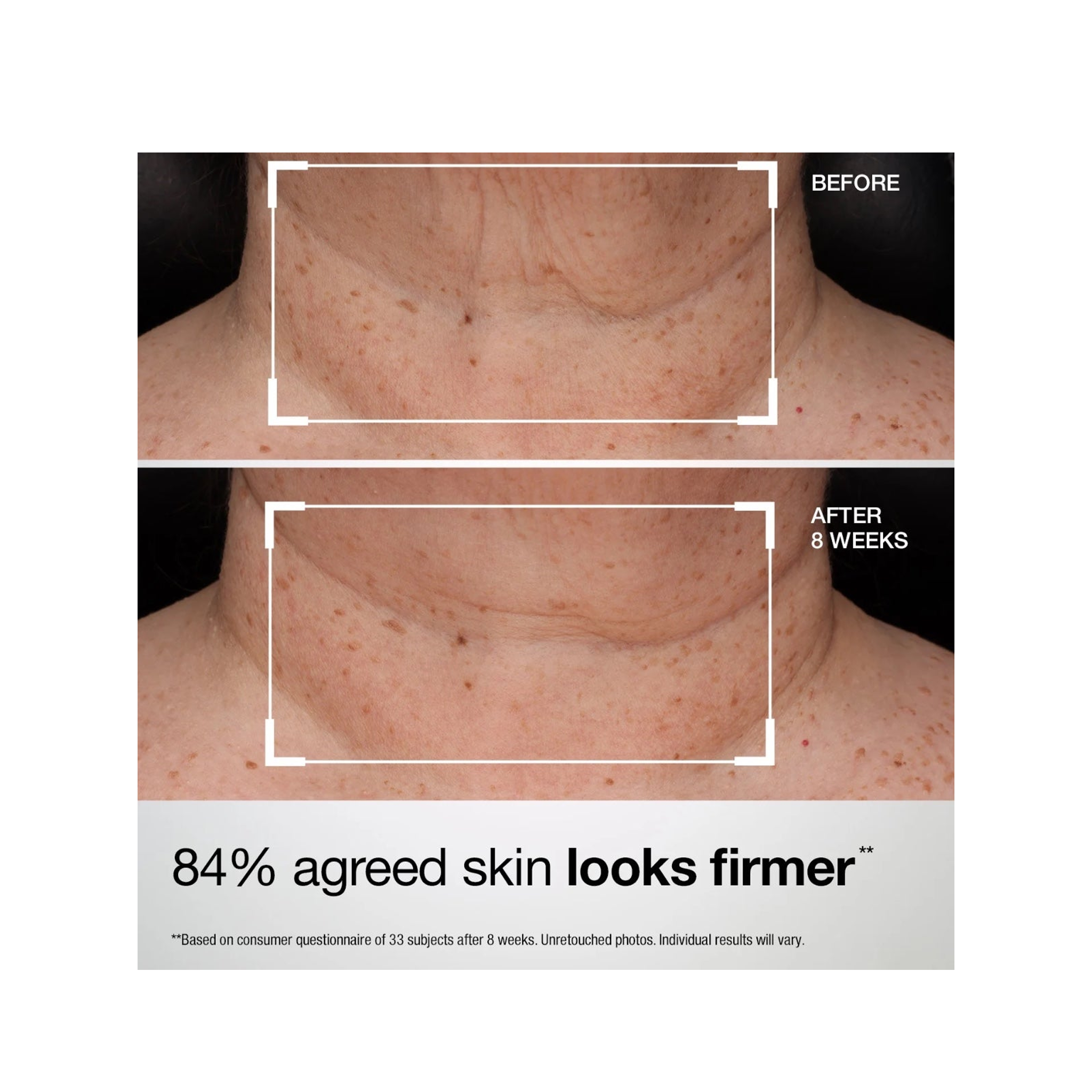 StriVectin TL Advanced Tightening Neck &amp; Chest Lotion SPF 35