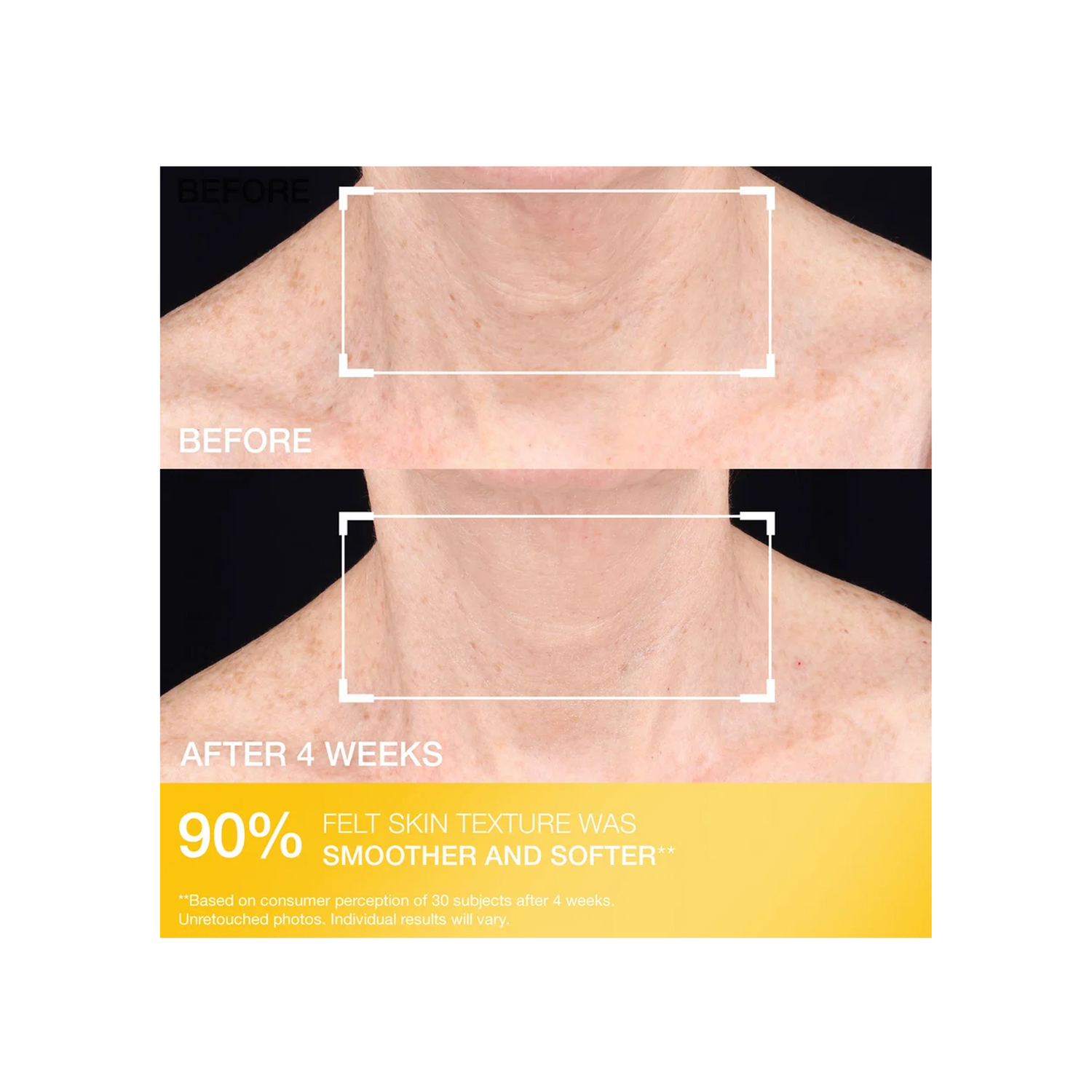 StriVectin Tightening Neck Cream PLUS With Alpha-3 Peptide 100ml