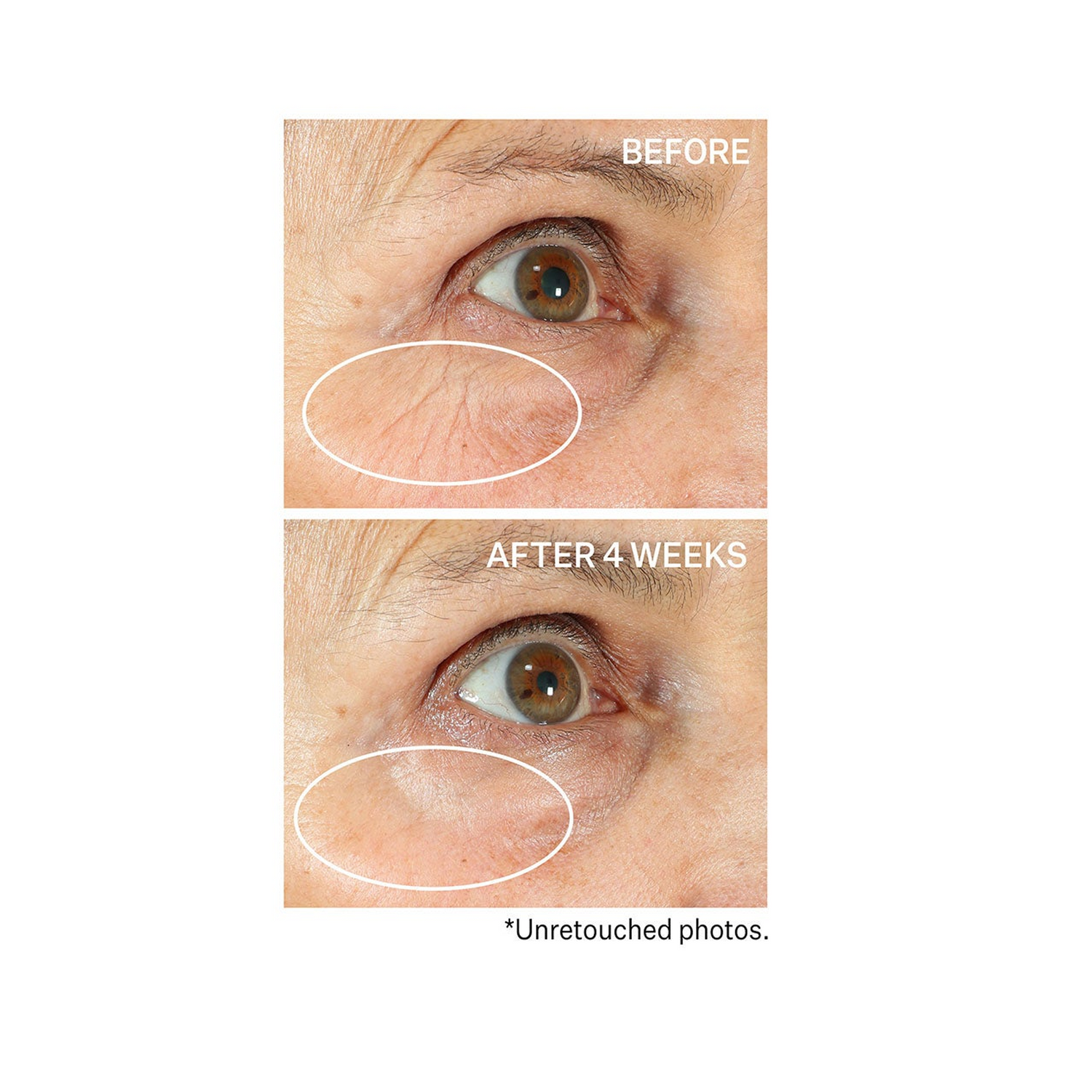 StriVectin Tighten &amp; Lift Peptight 360º Tightening Eye Serum