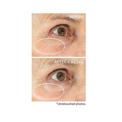 StriVectin Tighten &amp; Lift Peptight 360º Tightening Eye Serum