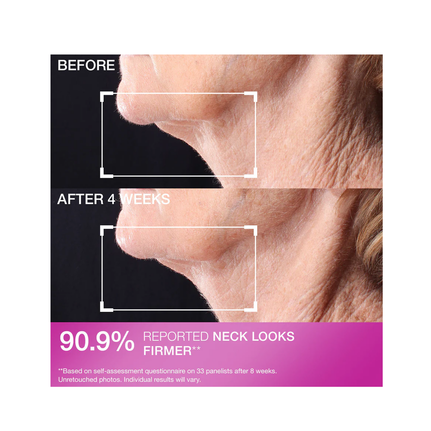 StriVectin Tighten &amp; Lift Peptight Tightening Neck Serum Roller