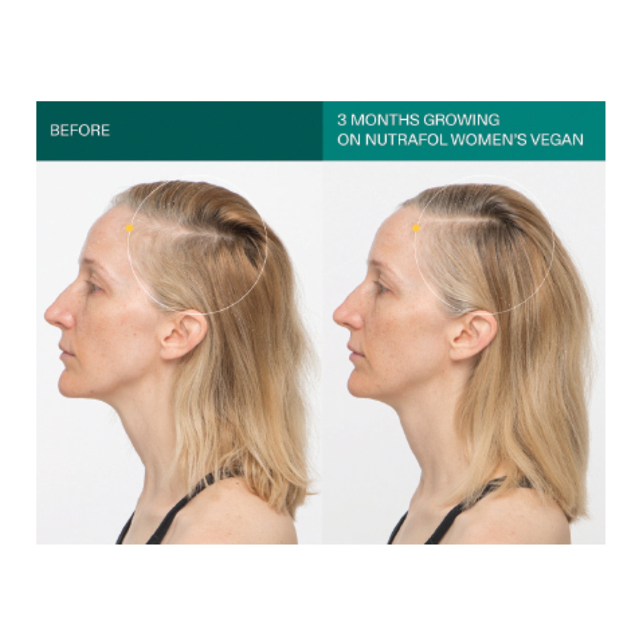 Nutrafol Postpartum