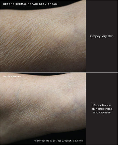 Sente Dermal Repair Body Cream