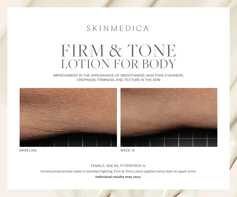 SkinMedica Firm &amp; Tone Lotion for Body