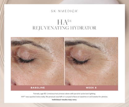 SkinMedica HA5 Rejuvenating Hydrator 2oz