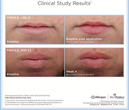 SkinMedica HA5 Smooth and Plump Lip System